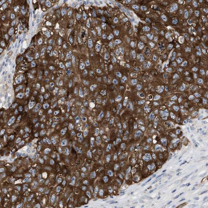 UBAP2 Antibody - BSA Free Immunohistochemistry: UBAP2 Antibody - BSA Free [NBP1-90829]