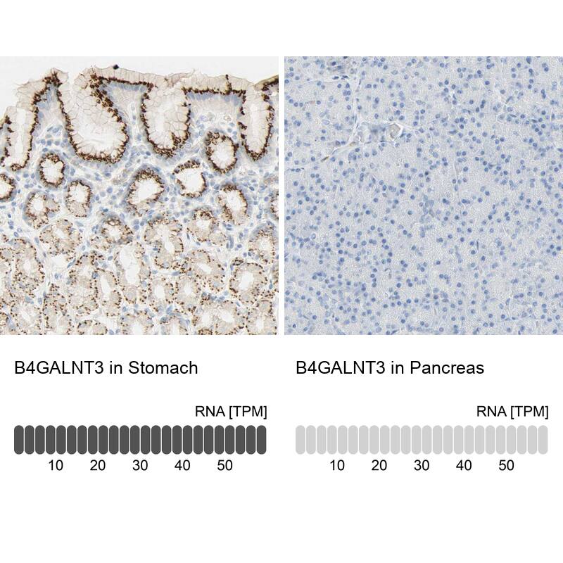 B4GALNT3 Antibody - BSA Free Immunohistochemistry: B4GALNT3 Antibody - BSA Free [NBP1-90836]