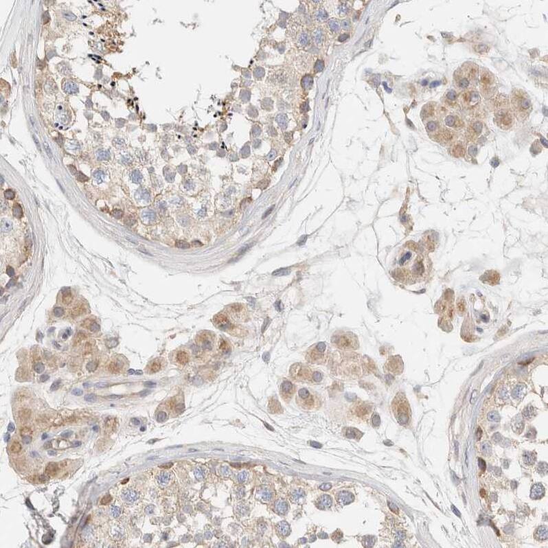 B3GNTL1 Antibody - BSA Free Immunohistochemistry: B3GNTL1 Antibody - BSA Free [NBP1-90838]