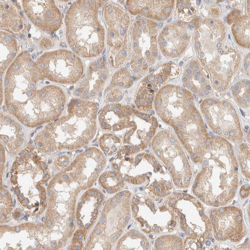 B3GNTL1 Antibody - BSA Free Immunohistochemistry: B3GNTL1 Antibody - BSA Free [NBP1-90838]