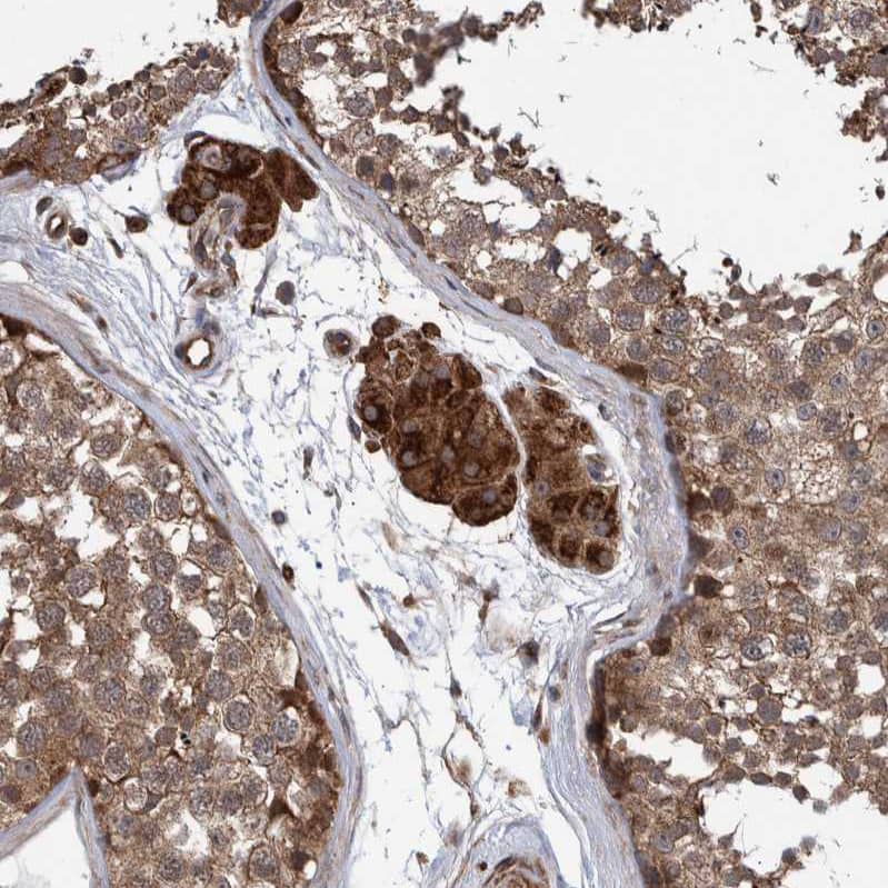 B3GNTL1 Antibody - BSA Free Immunohistochemistry: B3GNTL1 Antibody - BSA Free [NBP1-90839]