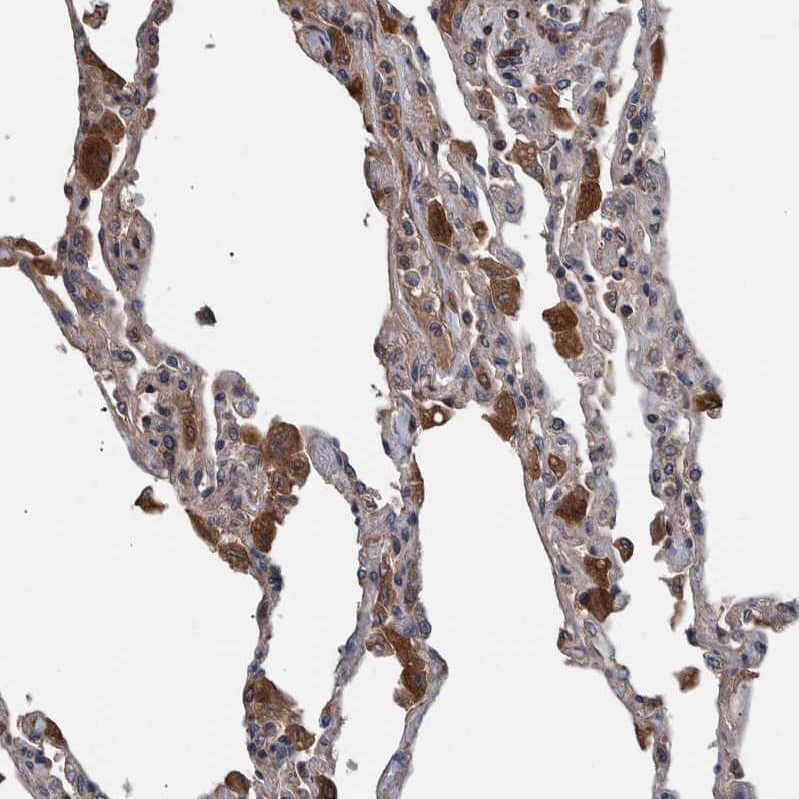 B3GNTL1 Antibody - BSA Free Immunohistochemistry: B3GNTL1 Antibody - BSA Free [NBP1-90839]