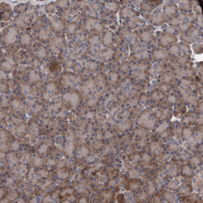 B3GNTL1 Antibody - BSA Free Immunohistochemistry: B3GNTL1 Antibody - BSA Free [NBP1-90839]