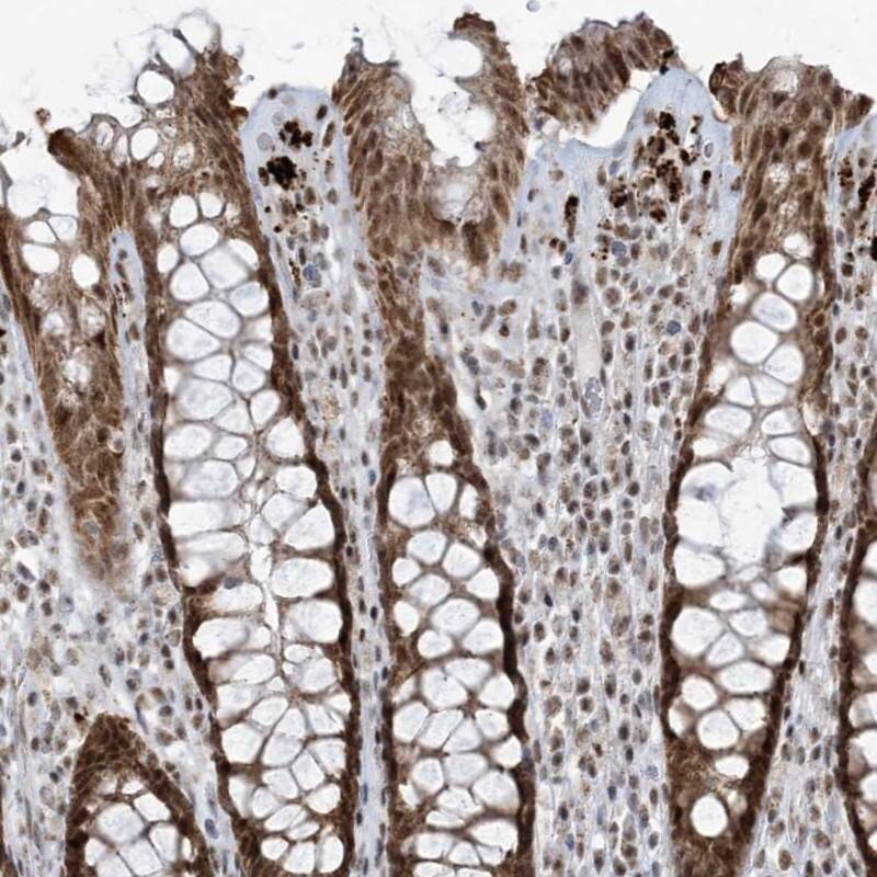 ECT2L Antibody - BSA Free Immunohistochemistry: ECT2L Antibody - BSA Free [NBP1-90847]