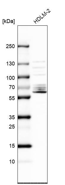 SPATA13 Antibody - BSA Free Western Blot: SPATA13 Antibody - BSA Free [NBP1-90848]