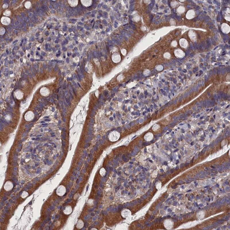SPATA13 Antibody - BSA Free Immunohistochemistry-Paraffin: SPATA13 Antibody [NBP1-90849]