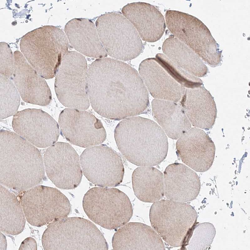 ARHGAP21 Antibody - BSA Free Immunohistochemistry: ARHGAP21 Antibody - BSA Free [NBP1-90852]