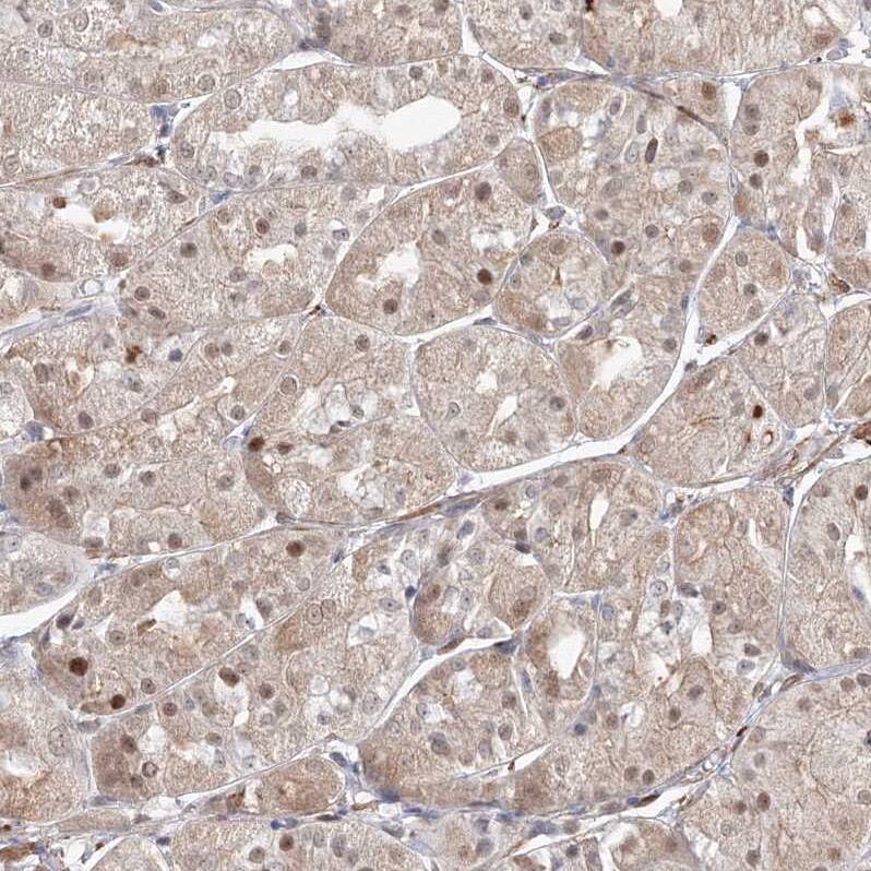 ARHGAP21 Antibody - BSA Free Immunohistochemistry: ARHGAP21 Antibody - BSA Free [NBP1-90852]