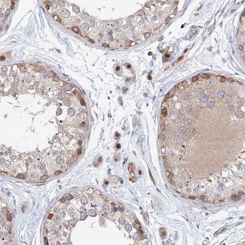 ARHGAP21 Antibody - BSA Free Immunohistochemistry: ARHGAP21 Antibody - BSA Free [NBP1-90852]