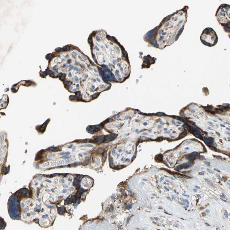 SDF2L1 Antibody - BSA Free Immunohistochemistry: SDF2L1 Antibody - BSA Free [NBP1-90854]