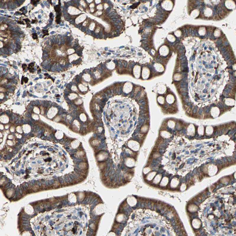 SDF2L1 Antibody - BSA Free Immunohistochemistry: SDF2L1 Antibody - BSA Free [NBP1-90854]