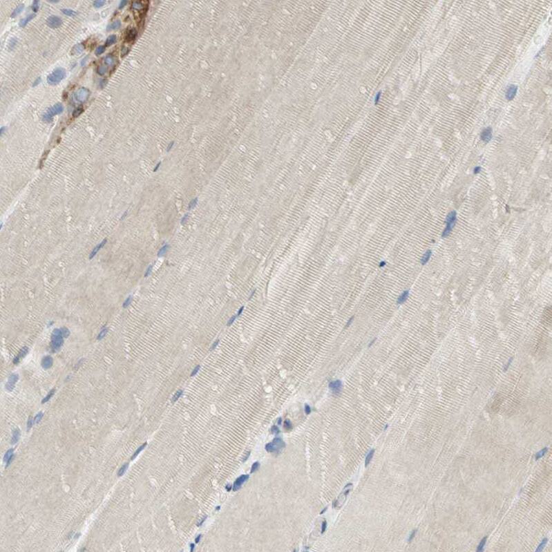 SDF2L1 Antibody - BSA Free Immunohistochemistry: SDF2L1 Antibody - BSA Free [NBP1-90854]