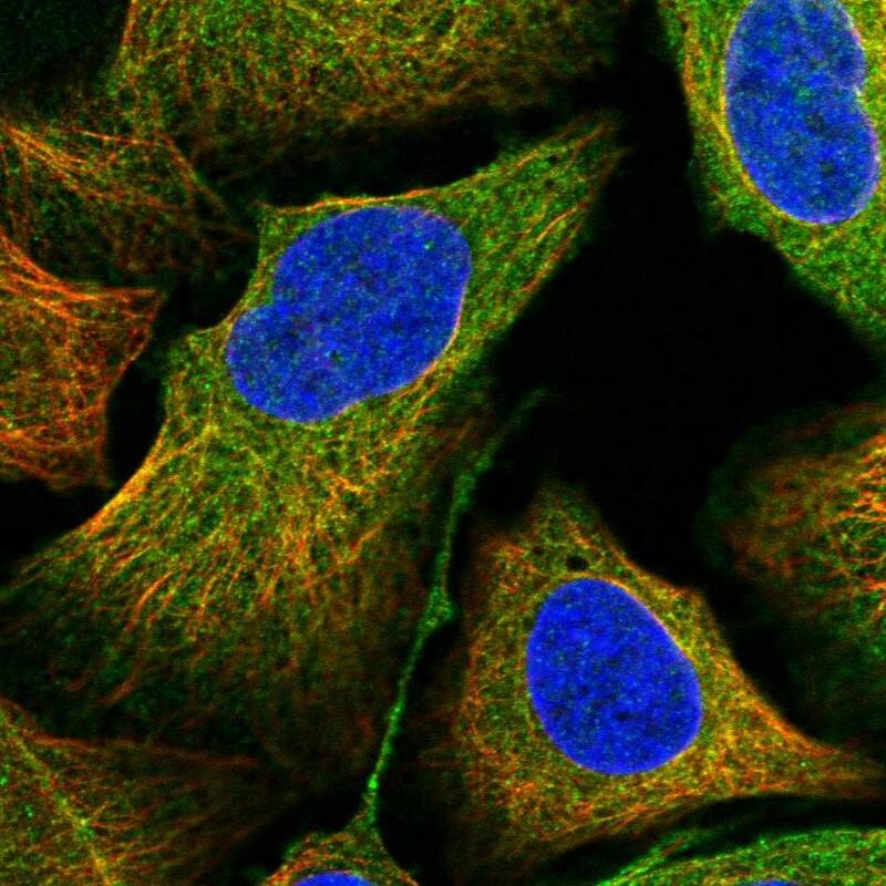 ANKRD34A Antibody - BSA Free Immunocytochemistry/ Immunofluorescence: ANKRD34A Antibody [NBP1-90855]