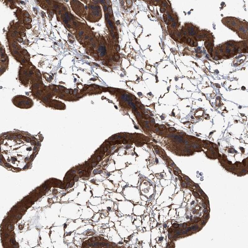 ANKRD34A Antibody - BSA Free Immunohistochemistry: ANKRD34A Antibody - BSA Free [NBP1-90856]