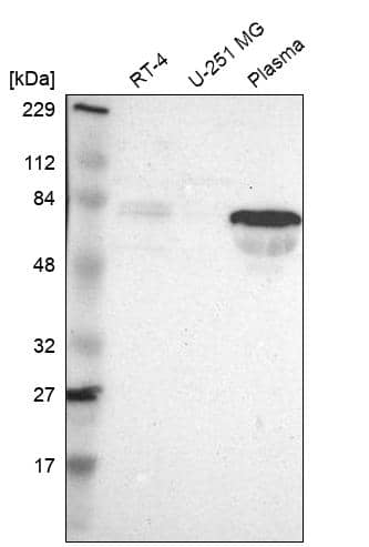 FAM117B Antibody - BSA Free Western Blot: FAM117B Antibody - BSA Free [NBP1-90861]