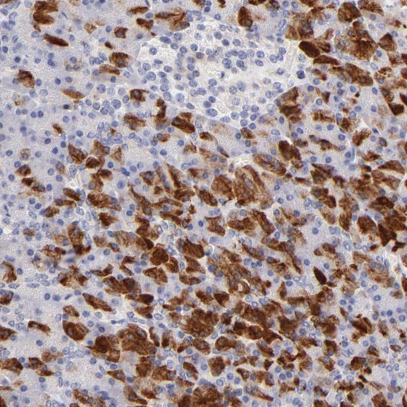 FAM117B Antibody - BSA Free Immunohistochemistry: FAM117B Antibody - BSA Free [NBP1-90861]