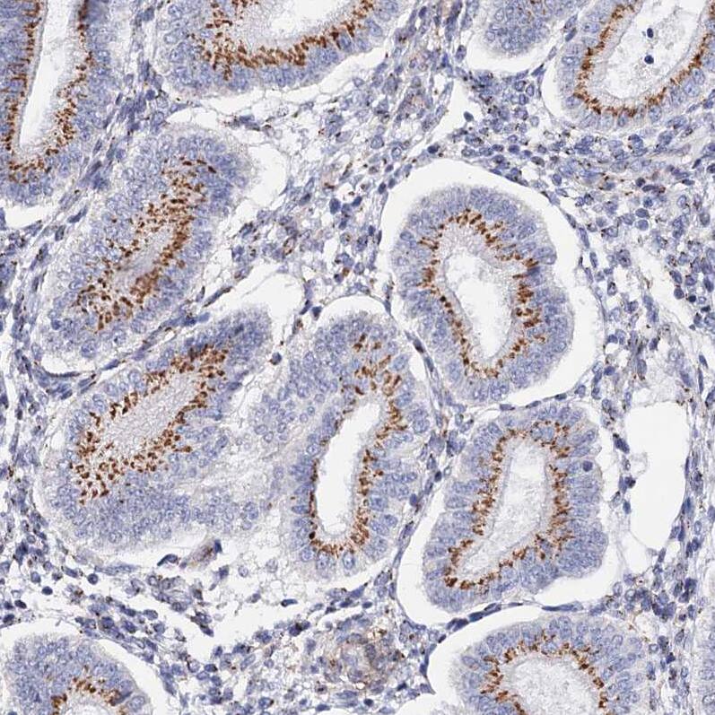 C11orf96 Antibody - BSA Free Immunohistochemistry: C11orf96 Antibody - BSA Free [NBP1-90866]