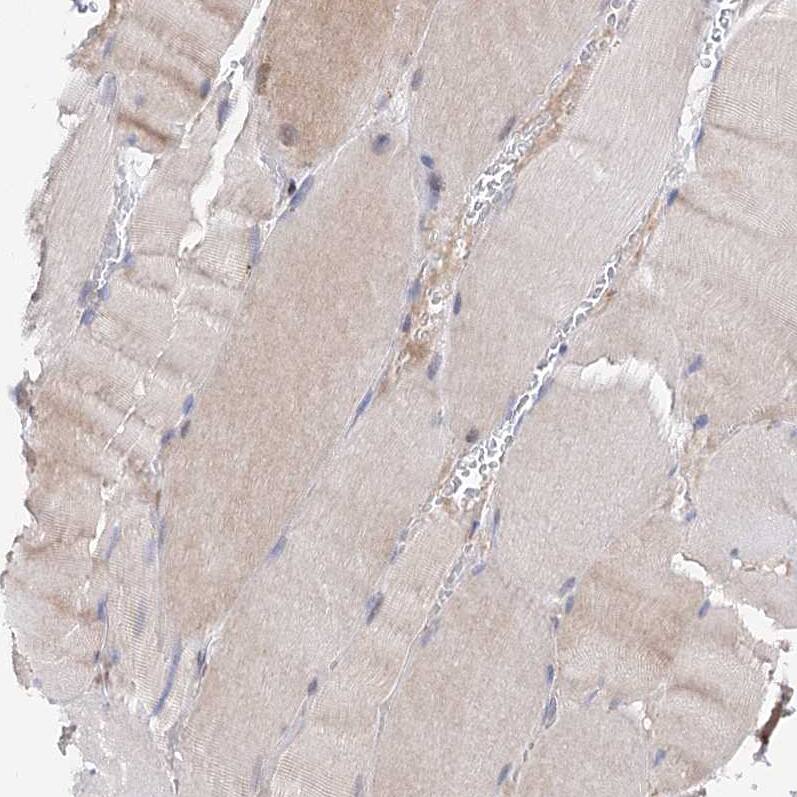 C11orf96 Antibody - BSA Free Immunohistochemistry: C11orf96 Antibody - BSA Free [NBP1-90866]