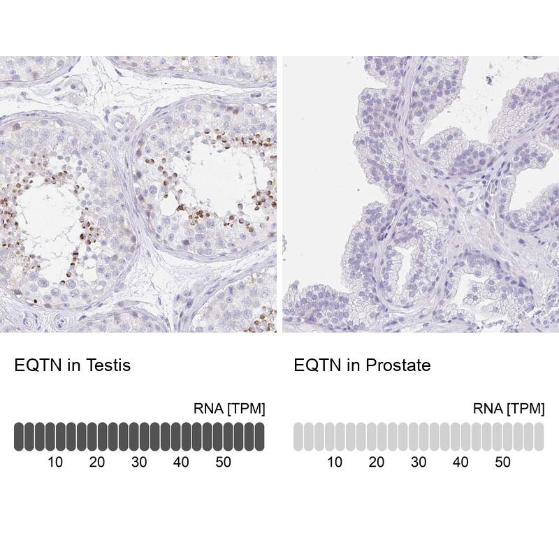 EQTN Antibody - BSA Free Immunohistochemistry: EQTN Antibody - BSA Free [NBP1-90868]