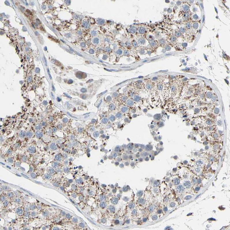GLT8D1 Antibody - BSA Free Immunohistochemistry: GLT8D1 Antibody - BSA Free [NBP1-90872]