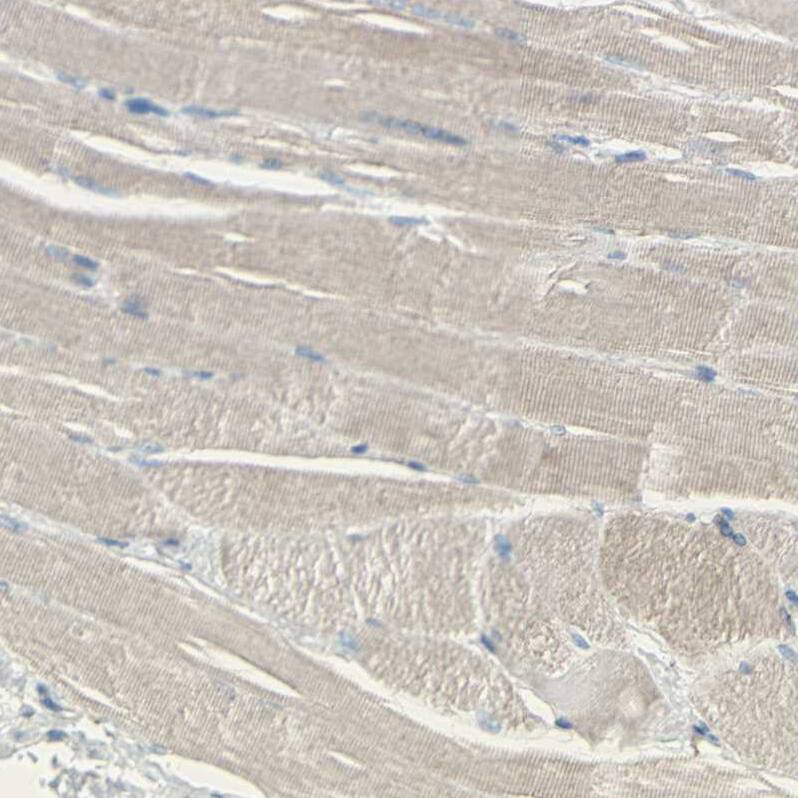 GLT8D1 Antibody - BSA Free Immunohistochemistry: GLT8D1 Antibody - BSA Free [NBP1-90872]