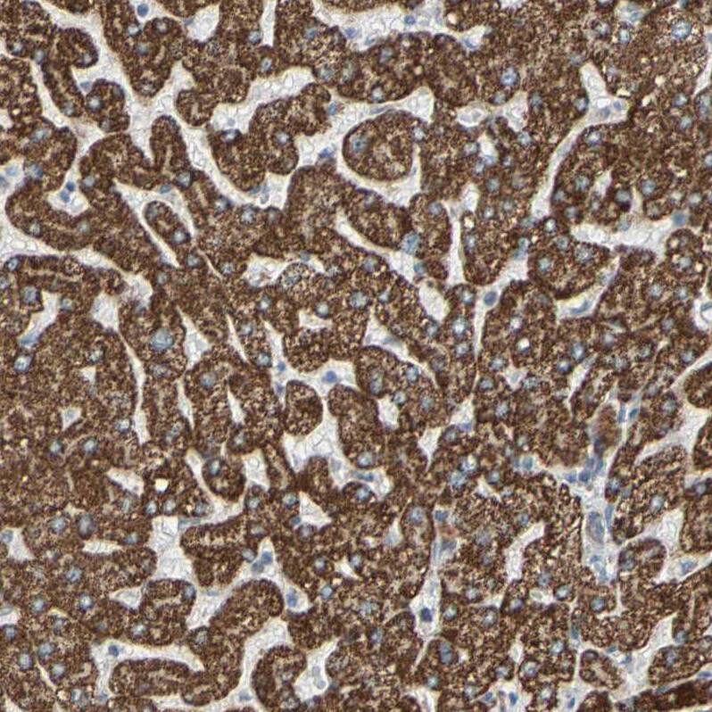 GLT8D1 Antibody - BSA Free Immunohistochemistry: GLT8D1 Antibody - BSA Free [NBP1-90872]