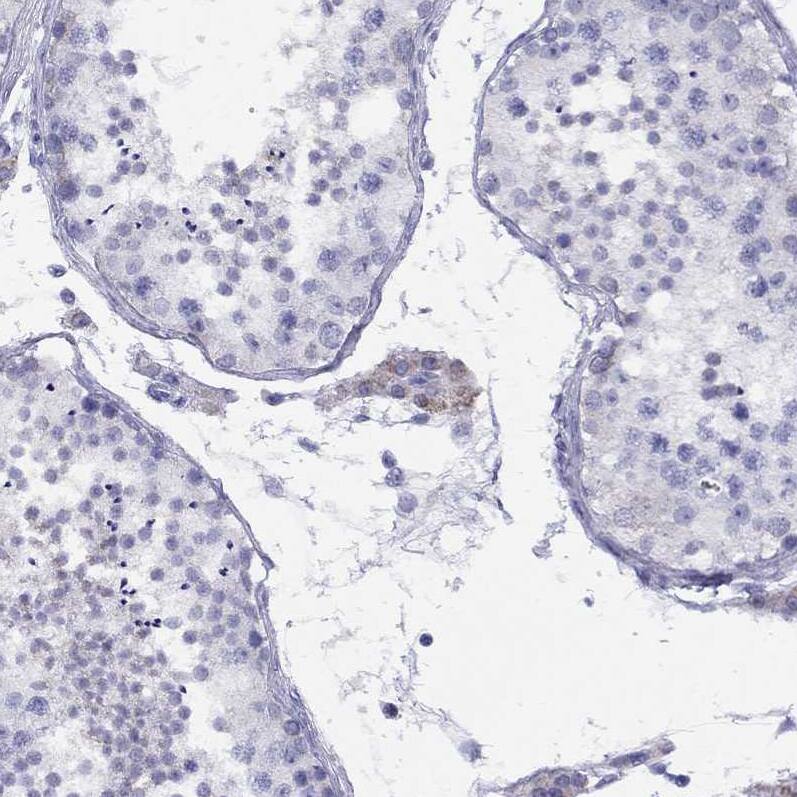 LRIT2 Antibody - BSA Free Immunohistochemistry: LRIT2 Antibody - BSA Free [NBP1-90876]