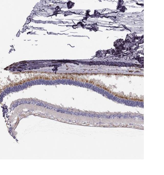 LRIT2 Antibody - BSA Free Immunohistochemistry: LRIT2 Antibody - BSA Free [NBP1-90876]
