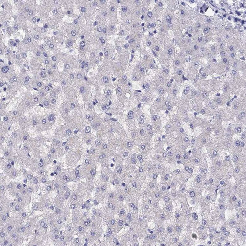 LRIT2 Antibody - BSA Free Immunohistochemistry: LRIT2 Antibody - BSA Free [NBP1-90876]