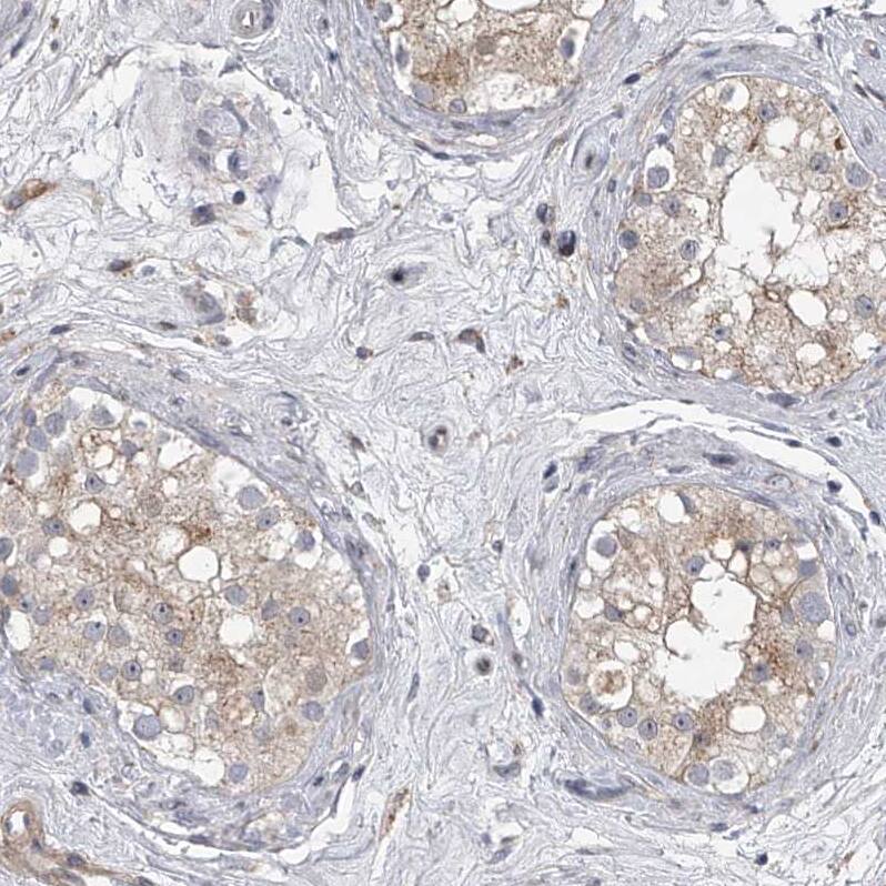 HEATR6 Antibody - BSA Free Immunohistochemistry: HEATR6 Antibody - BSA Free [NBP1-90877]