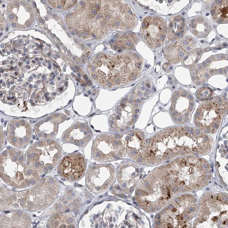 HEATR6 Antibody - BSA Free Immunohistochemistry: HEATR6 Antibody - BSA Free [NBP1-90877]