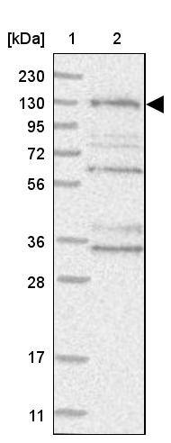 HEATR6 Antibody - BSA Free Western Blot: HEATR6 Antibody - BSA Free [NBP1-90877]