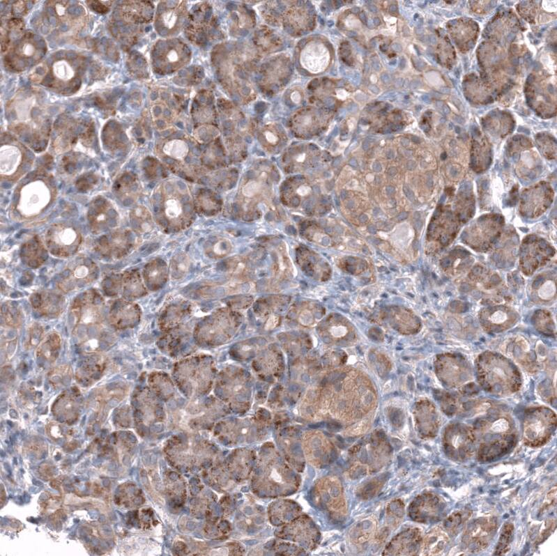 ZSWIM8 Antibody - BSA Free Immunohistochemistry: ZSWIM8 Antibody - BSA Free [NBP1-90878]