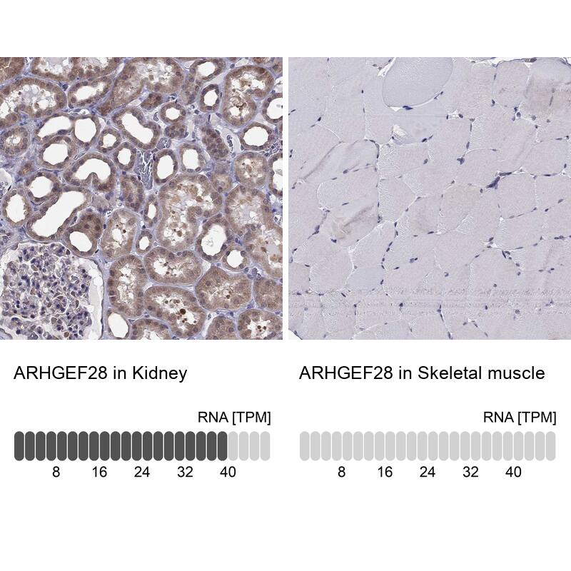 RGNEF Antibody - BSA Free Immunohistochemistry: RGNEF Antibody - BSA Free [NBP1-90880]