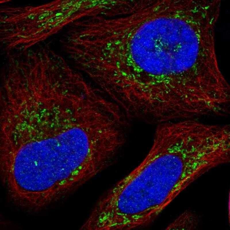 SLC25A26 Antibody - BSA Free Immunocytochemistry/ Immunofluorescence: SLC25A26 Antibody [NBP1-90881]