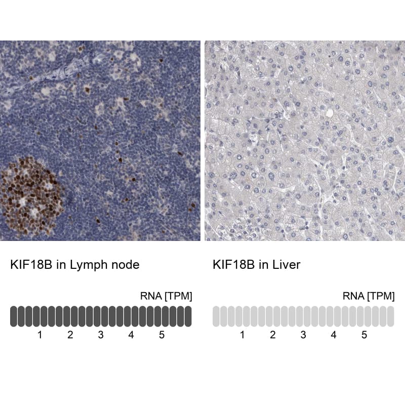 KIF18B Antibody - BSA Free Immunohistochemistry: KIF18B Antibody - BSA Free [NBP1-90882]