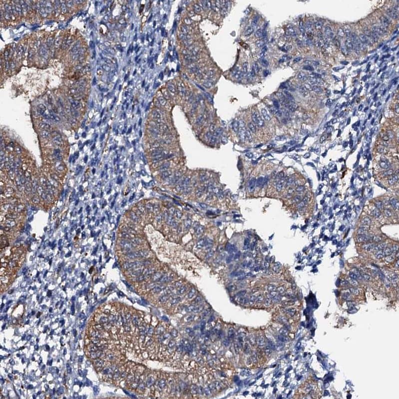 MS4A4E Antibody - BSA Free Immunohistochemistry: MS4A4E Antibody - BSA Free [NBP1-90895]