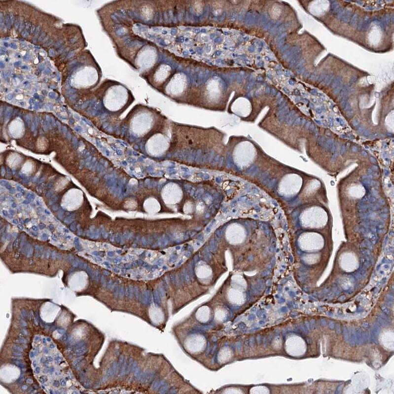 MS4A4E Antibody - BSA Free Immunohistochemistry: MS4A4E Antibody - BSA Free [NBP1-90895]