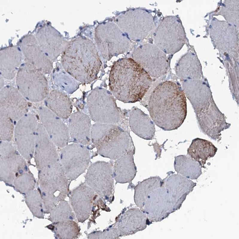 MS4A4E Antibody - BSA Free Immunohistochemistry: MS4A4E Antibody - BSA Free [NBP1-90895]