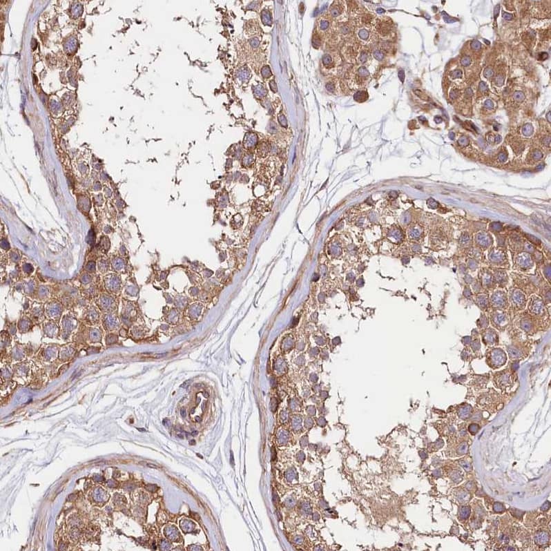 CEP295 Antibody - BSA Free Immunohistochemistry: CEP295 Antibody - BSA Free [NBP1-90900]