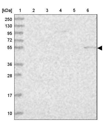 PSAPL1 Antibody - BSA Free Western Blot: PSAPL1 Antibody - BSA Free [NBP1-90903]