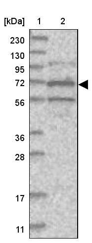 ANKRD56 Antibody - BSA Free Western Blot: ANKRD56 Antibody - BSA Free [NBP1-90905]