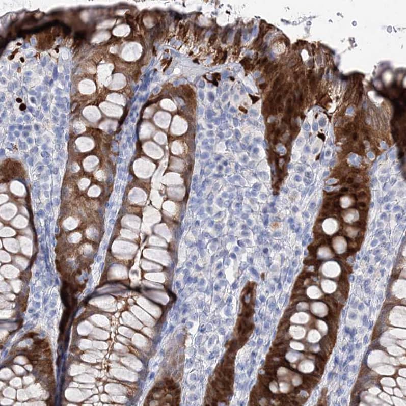 UDP glucose dehydrogenase Antibody - BSA Free Immunohistochemistry: UDP glucose dehydrogenase Antibody - BSA Free [NBP1-90906]