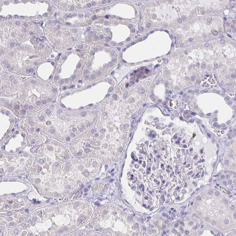 CFAP74 Antibody - BSA Free Immunohistochemistry: CFAP74 Antibody - BSA Free [NBP1-90921]