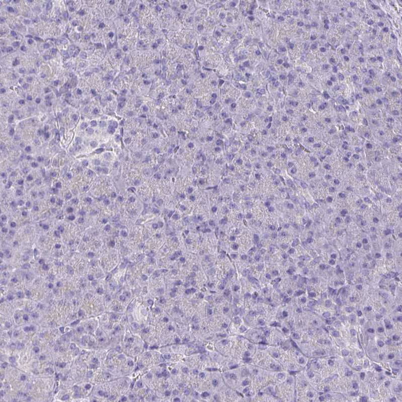 CFAP74 Antibody - BSA Free Immunohistochemistry: CFAP74 Antibody - BSA Free [NBP1-90921]