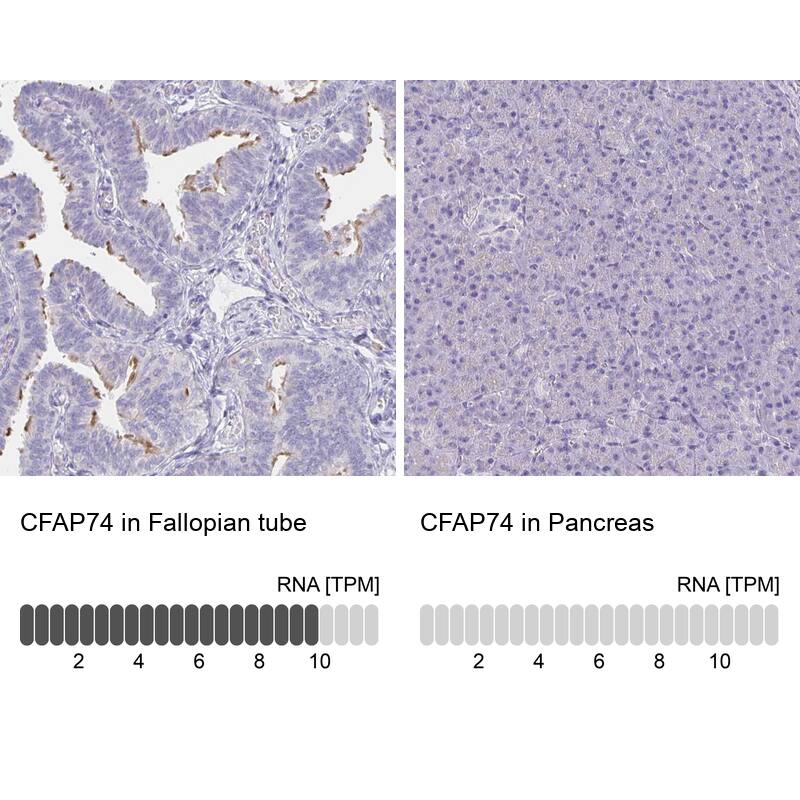 CFAP74 Antibody - BSA Free Immunohistochemistry: CFAP74 Antibody - BSA Free [NBP1-90921]