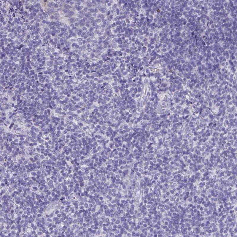 CFAP74 Antibody - BSA Free Immunohistochemistry: CFAP74 Antibody - BSA Free [NBP1-90921]