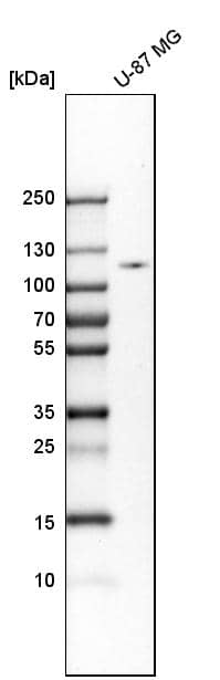 Hexokinase 2 Antibody - BSA Free Western Blot: Hexokinase 2 Antibody - BSA Free [NBP1-90922]