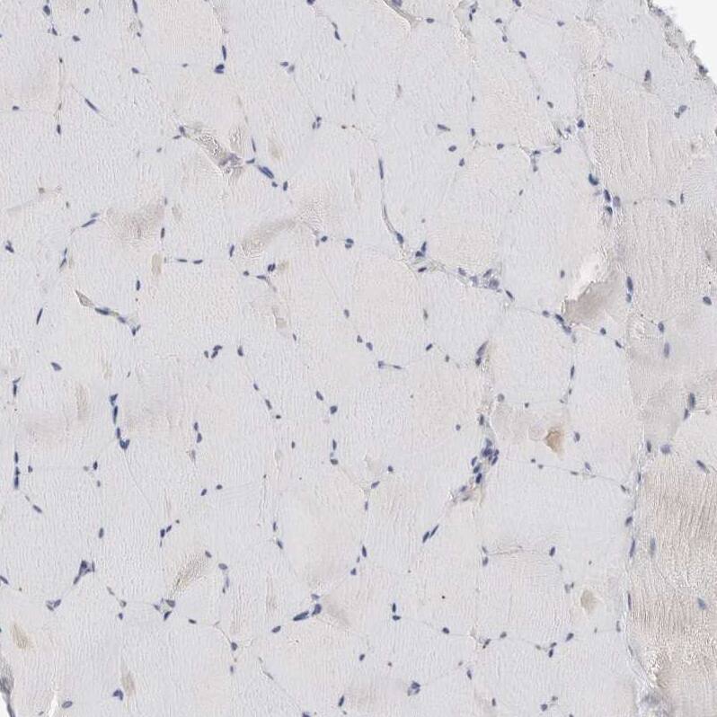 SYTL5 Antibody - BSA Free Immunohistochemistry: SYTL5 Antibody - BSA Free [NBP1-90926]