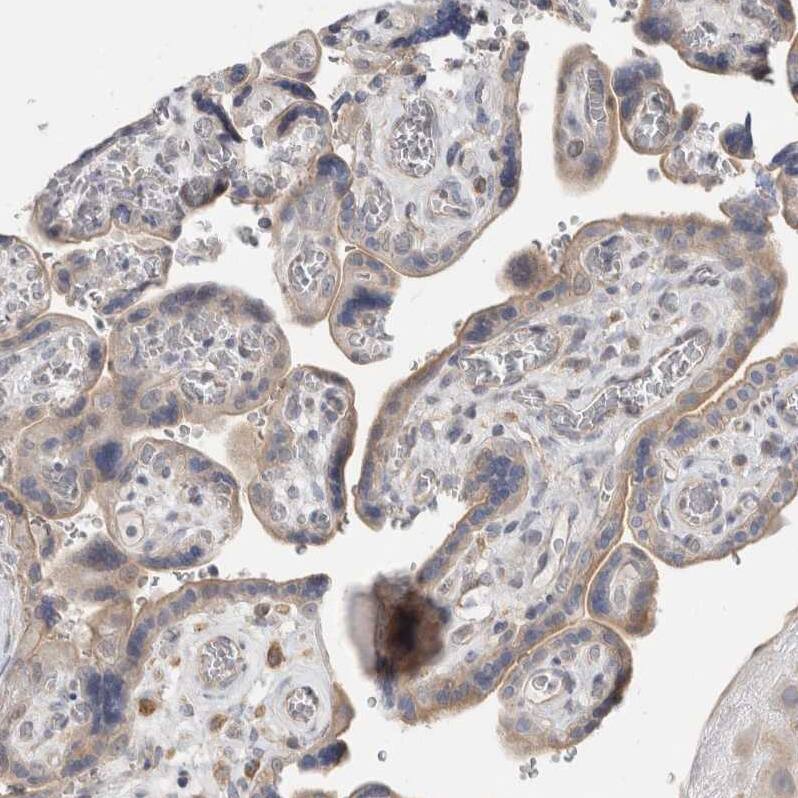 SYTL5 Antibody - BSA Free Immunohistochemistry: SYTL5 Antibody - BSA Free [NBP1-90926]